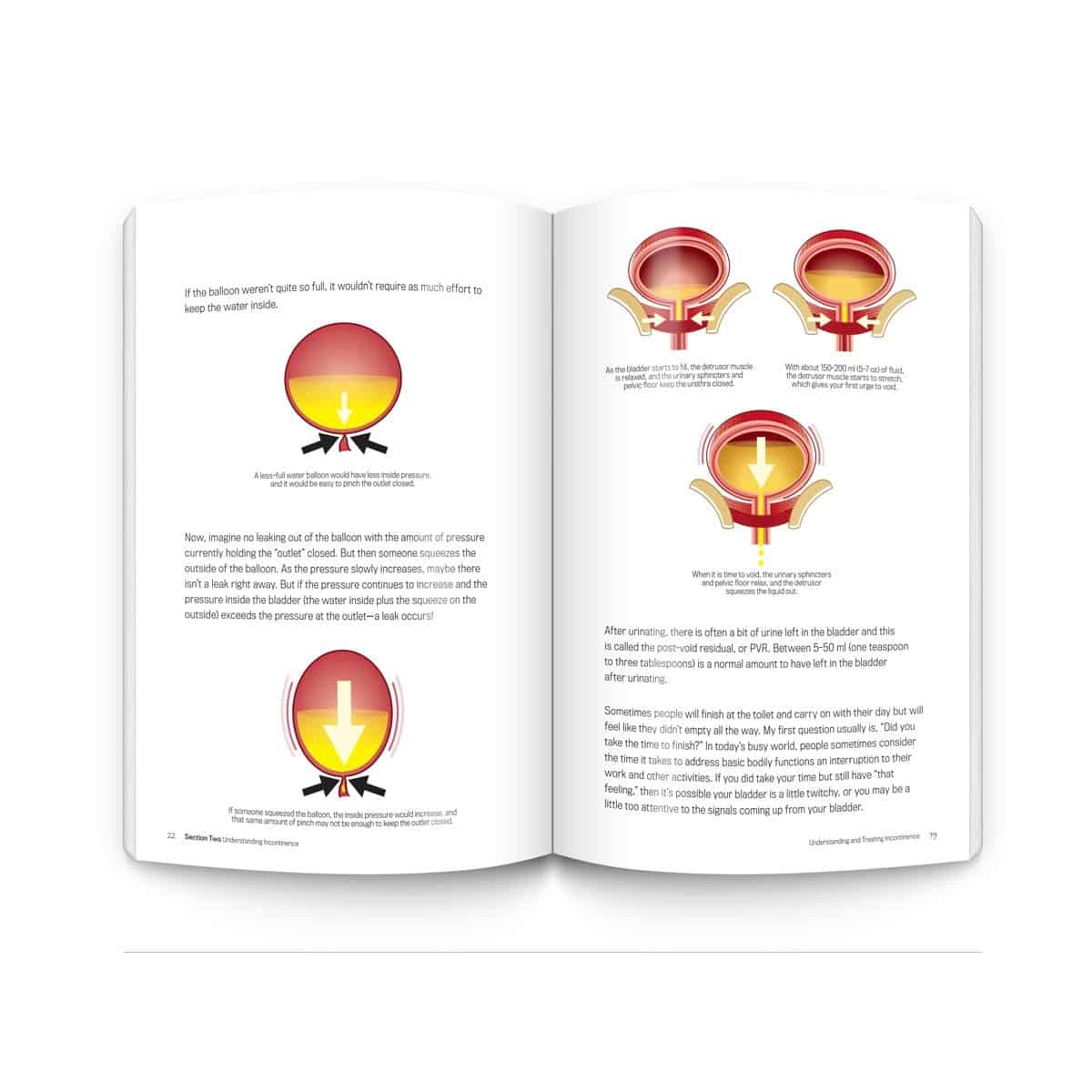 Understanding and Treating Incontinence - Softcover Book - Senior.com Books